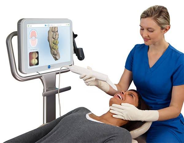 INTRA ORAL DIGITAL SCANNER